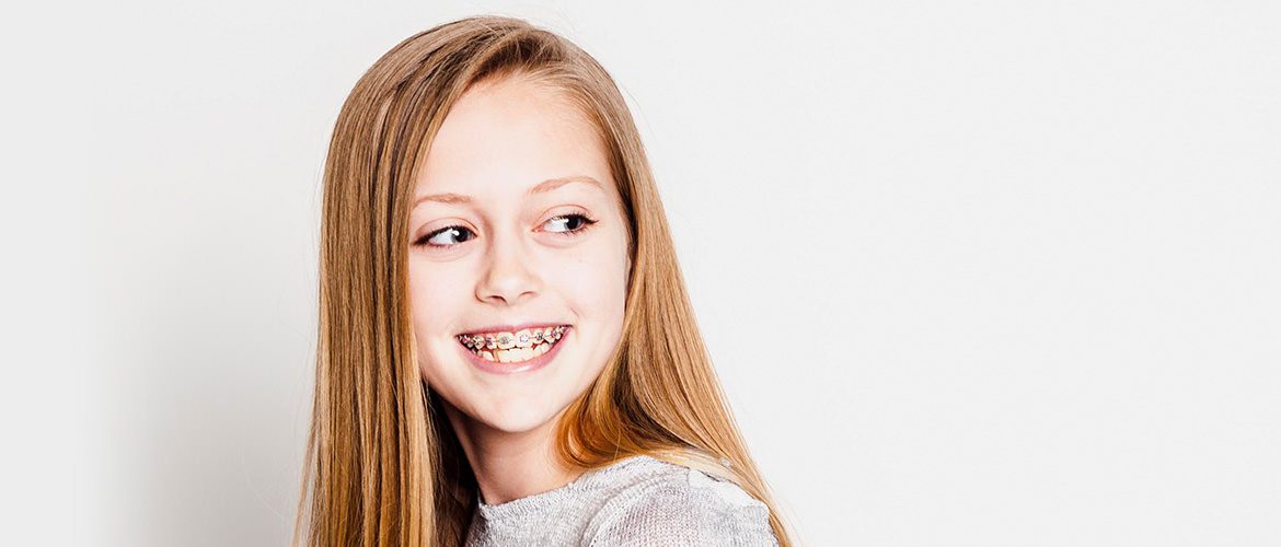 Braces Cost Southern WI Orthodontists Bubon Orthodontics