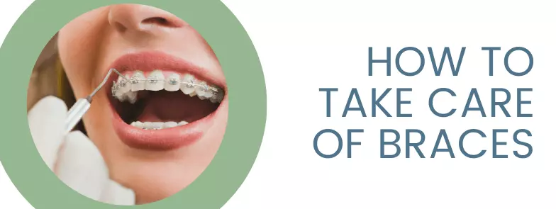 How To Take Care Of Braces Blog Header
