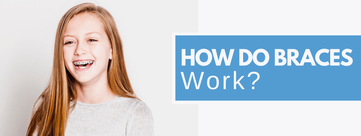 how do braces work