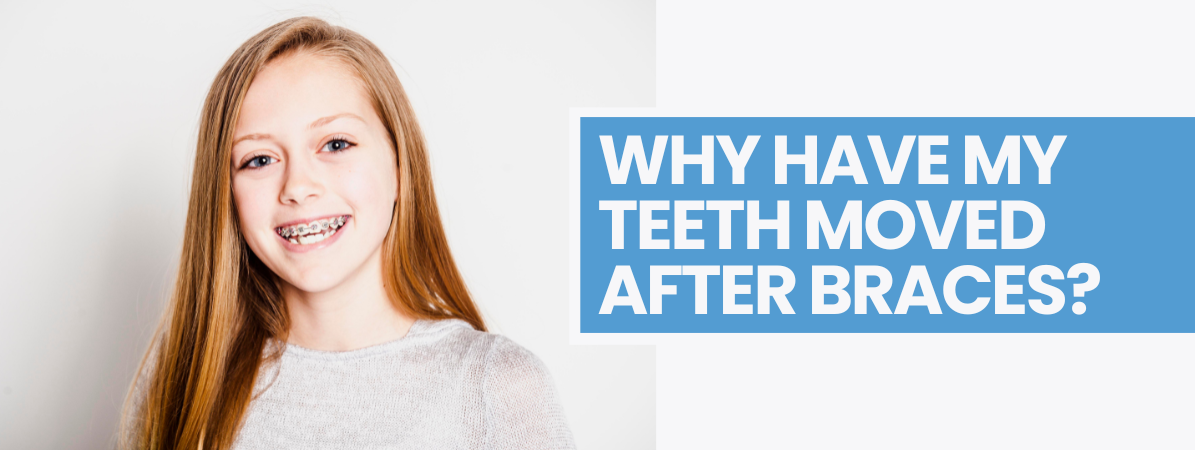 teeth moved after braces