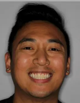 Darryl DPO after