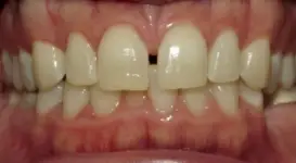 Jason Bubon DPO teeth