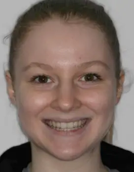 Karolina After